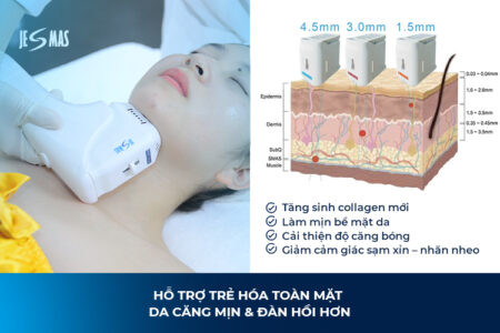 HIFU Làm Tăng Sinh Collagen Như Thế Nào?