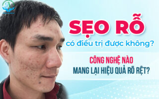 Trị Sẹo Rỗ Hiệu Quả #1 – Phác Đồ Chuẩn Da Liễu Từ A–Z