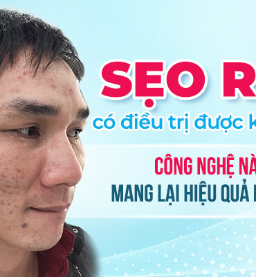 Trị Sẹo Rỗ Hiệu Quả #1 – Phác Đồ Chuẩn Da Liễu Từ A–Z