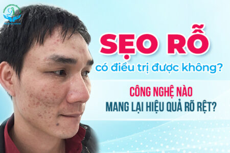 Trị Sẹo Rỗ Hiệu Quả #1 – Phác Đồ Chuẩn Da Liễu Từ A–Z